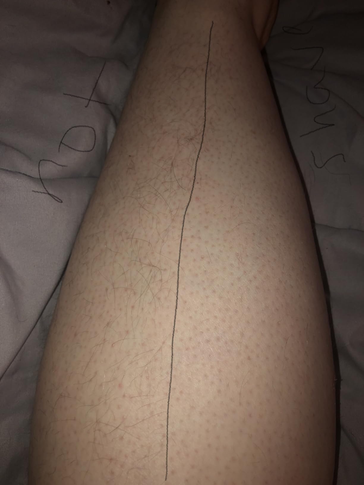 Philips SatinShave Essential Women's Wet & Dry Electric Shaver for Legs & Body, Cordless, with Hypoallergenic Foil, HP6306/50 customer photo 1