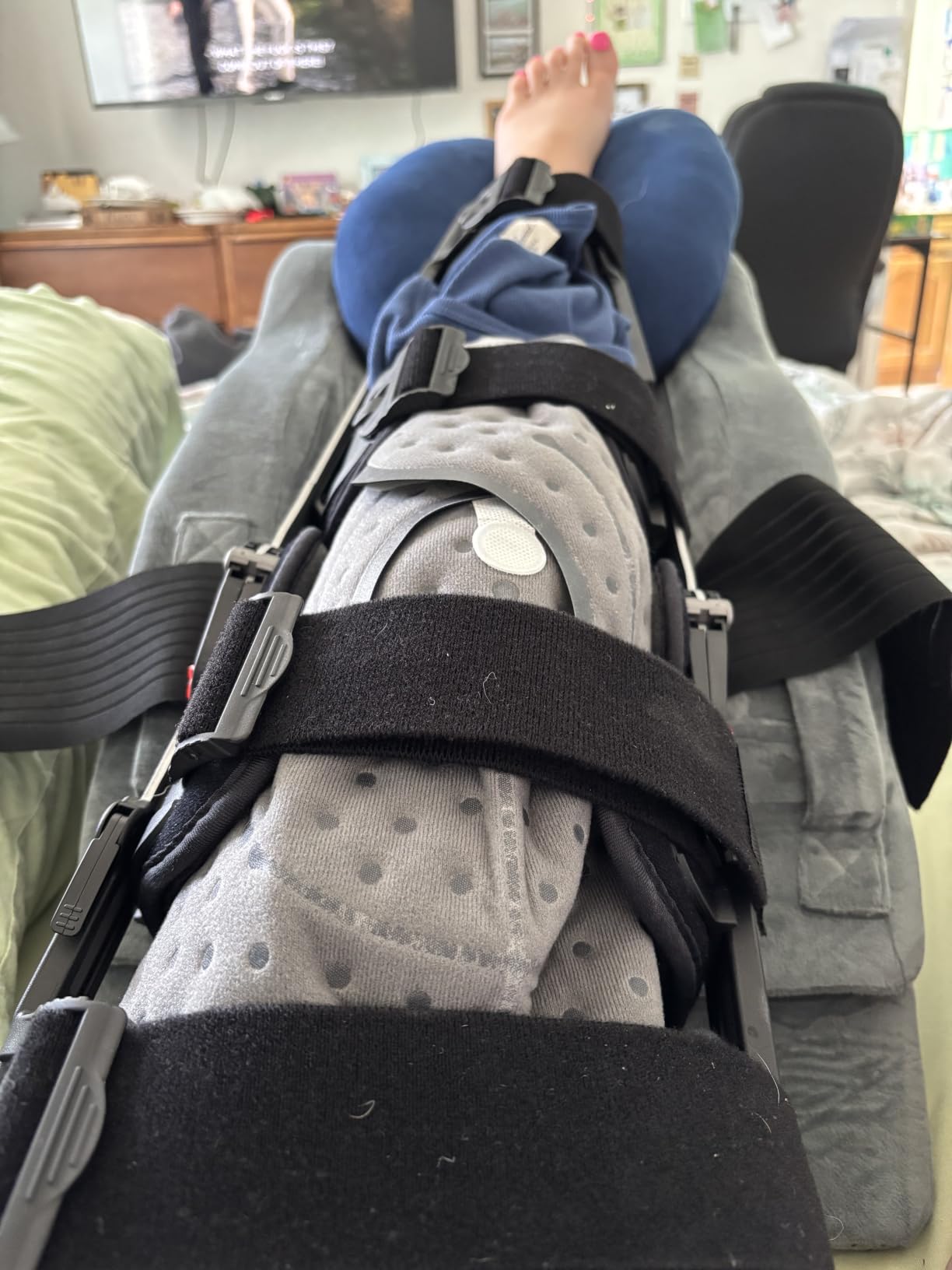 ICYTHRP Programmable Timer Ice Machine for Knee After Surgery w/Quiet Pump | FSA Eligible HSA, Portable Cold Therapy Machine, Programmable Recovery System for ACL, TKR & Sports Training w/ Universal Pad customer photo 1