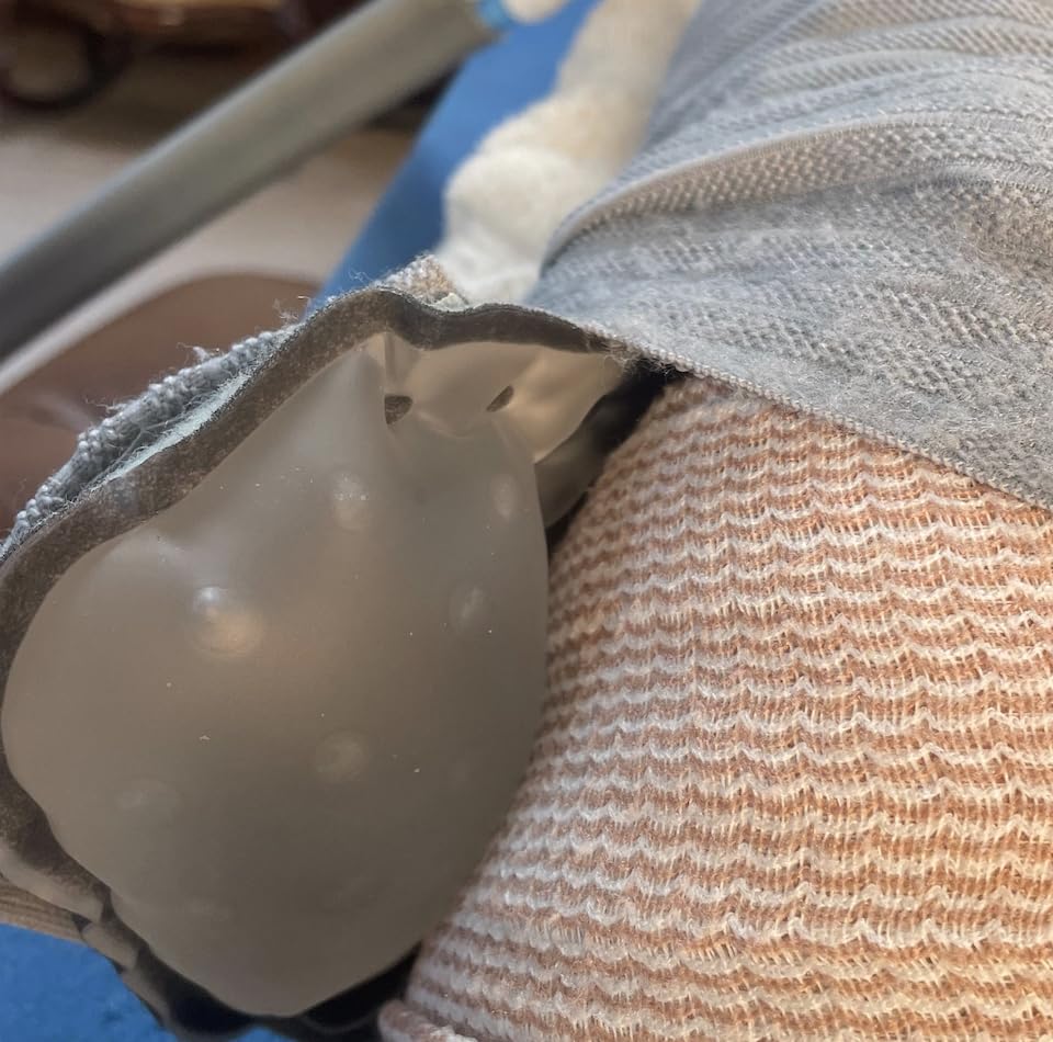 Iceman CLASSIC3 Cold Therapy Unit customer photo 1