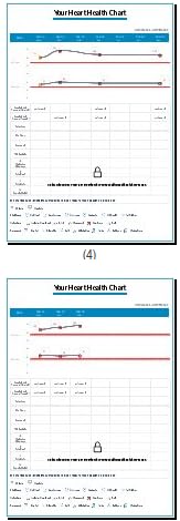 OMRON Complete 2-in-1 Blood Pressure Monitor + EKG for Home Use | Upper Arm Blood Pressure Cuff - #1 Doctor & Pharmacist Recommended Brand - Clinically Validated - Connect App customer photo 1