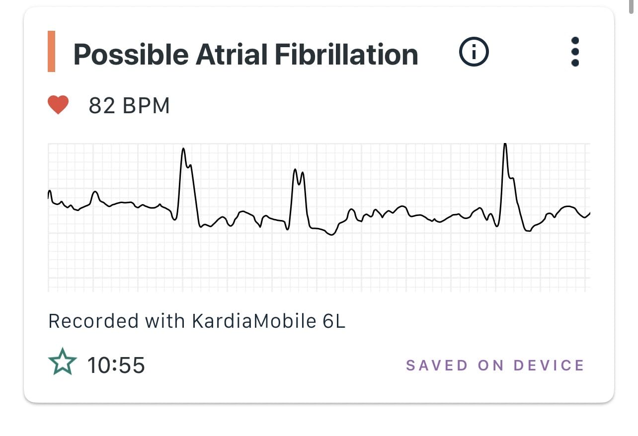 KardiaMobile 6-Lead Personal EKG Monitor - Six Views of The Heart - Detects AFib and Irregular Arrhythmias - Instant Results in 30 Seconds - Works with Most Smartphones - FSA/HSA Eligible customer photo 2