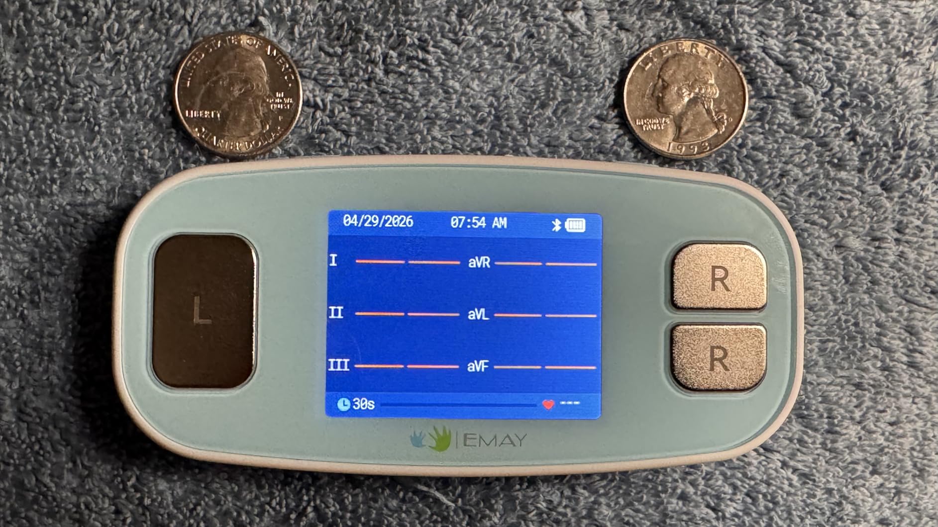 EMAY 6L Portable ECG Monitor | Record ECG and Heart Rate in 6 Channels | Compatible with Smartphone and PC | No Subscription Required customer photo 1
