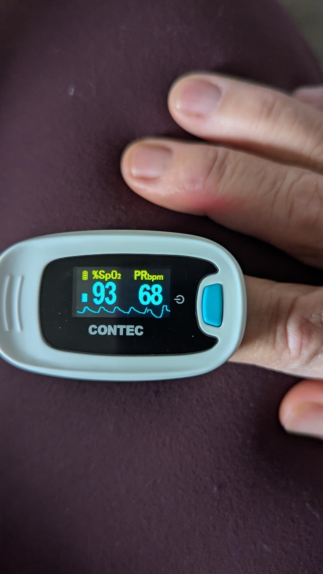 CONTEC Pulse Oximeter, SpO2 & PR Waveform Blood Oxygen Monitor w/Lanyard customer photo 2