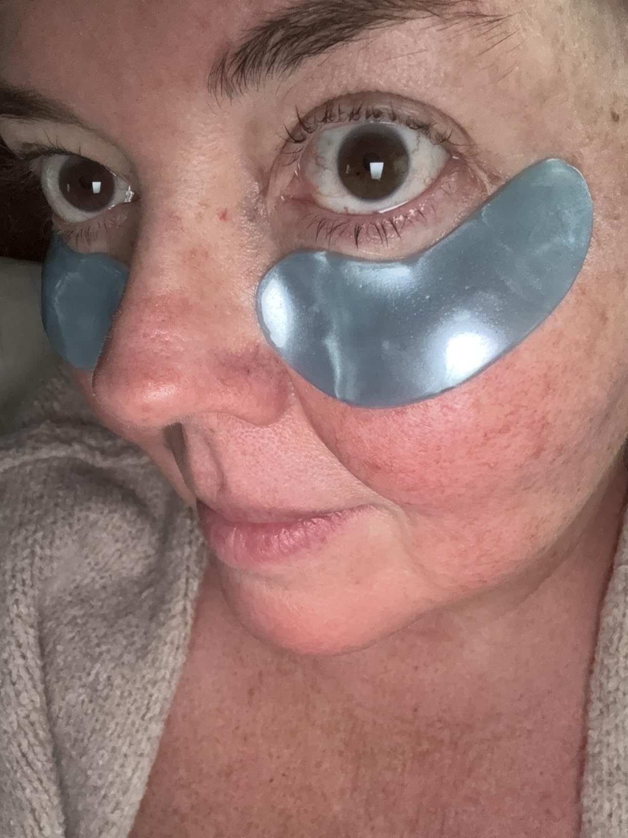 grace and stella Eye Patches customer photo 1